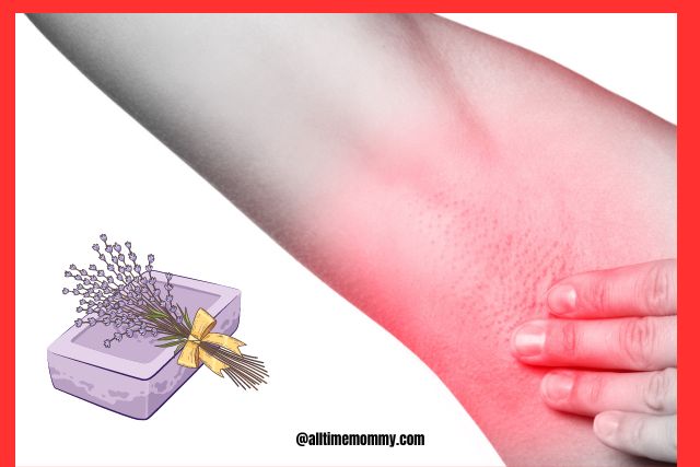 itchy armpits no rash