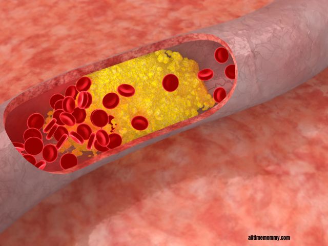 ldl cholesterol